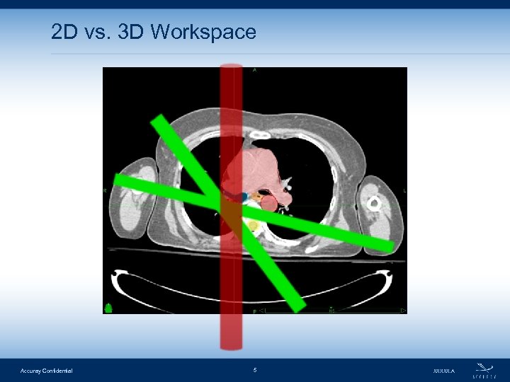 2 D vs. 3 D Workspace Accuray Confidential 5 XXXXX. A 