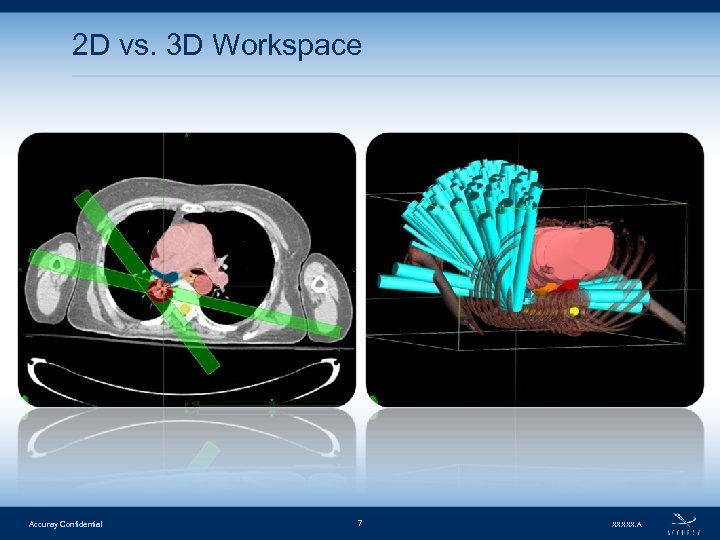 2 D vs. 3 D Workspace Accuray Confidential 7 XXXXX. A 