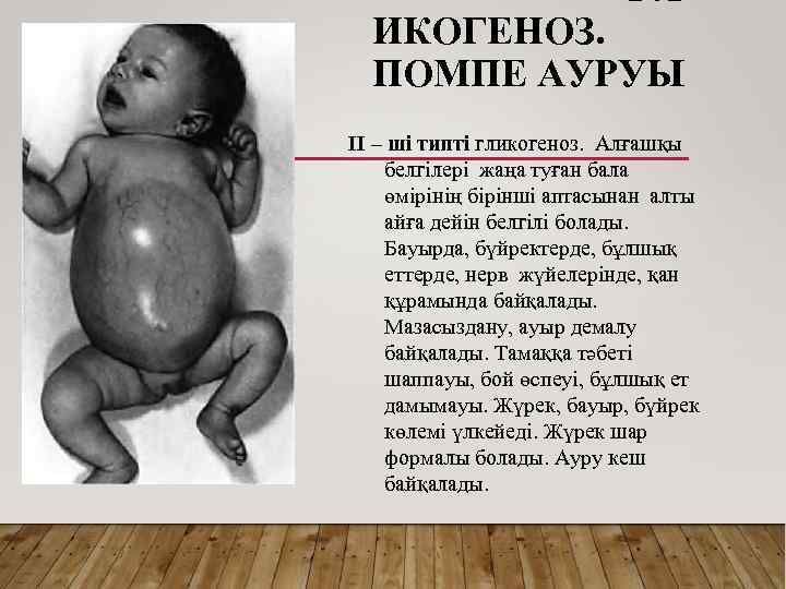 ГЛ ИКОГЕНОЗ. ПОМПЕ АУРУЫ II – ші типті гликогеноз. Алғашқы белгілері жаңа туған бала