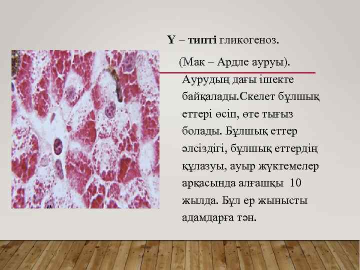 Y – типті гликогеноз. (Мак – Ардле ауруы). Аурудың дағы ішекте байқалады. Скелет бұлшық