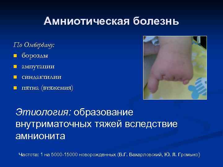 Амниотическая болезнь По Омбердану: n борозды n ампутации n синдактилии n пятна (втяжения) Этиология: