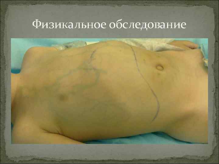 Физикальное обследование 