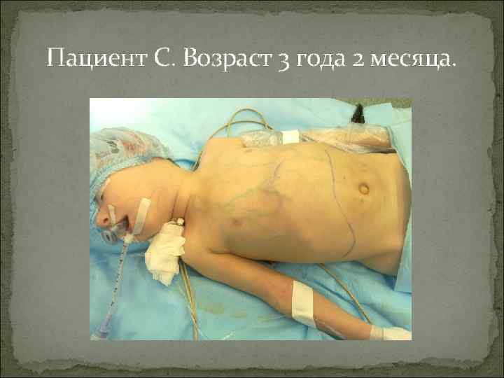 Пациент С. Возраст 3 года 2 месяца. 