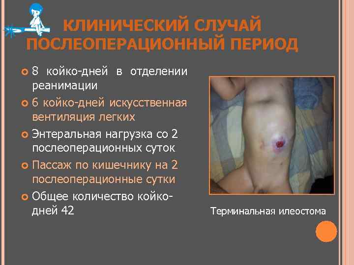 КЛИНИЧЕСКИЙ СЛУЧАЙ ПОСЛЕОПЕРАЦИОННЫЙ ПЕРИОД 8 койко-дней в отделении реанимации 6 койко-дней искусственная вентиляция легких