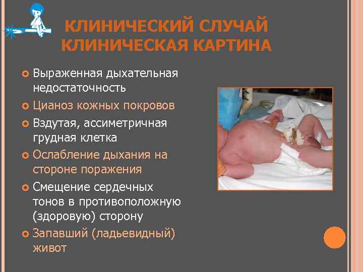 КЛИНИЧЕСКИЙ СЛУЧАЙ КЛИНИЧЕСКАЯ КАРТИНА Выраженная дыхательная недостаточность Цианоз кожных покровов Вздутая, ассиметричная грудная клетка