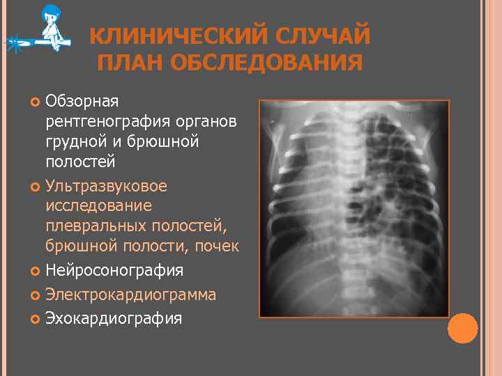 КЛИНИЧЕСКИЙ СЛУЧАЙ ПЛАН ОБСЛЕДОВАНИЯ Обзорная рентгенография органов грудной и брюшной полостей Ультразвуковое исследование плевральных