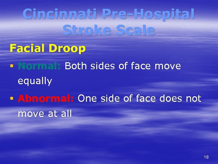 Cincinnati Pre-Hospital Stroke Scale Facial Droop § Normal: Both sides of face move equally