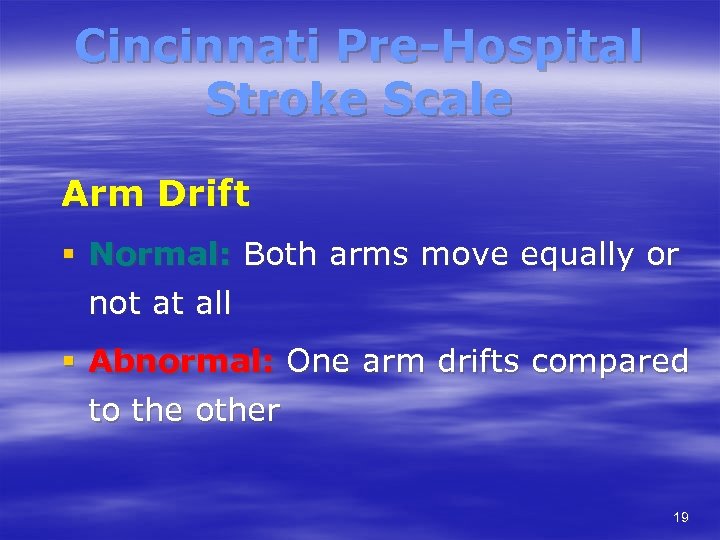 Cincinnati Pre-Hospital Stroke Scale Arm Drift § Normal: Both arms move equally or not