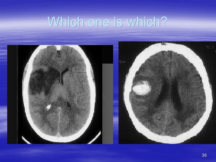 Which one is which? 36 