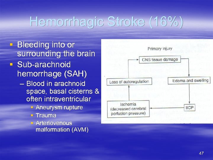 Hemorrhagic Stroke (16%) § Bleeding into or surrounding the brain § Sub-arachnoid hemorrhage (SAH)