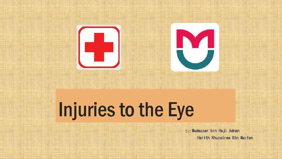 Injuries to the Eye By: Mudezzer bin Haji Adnan Harith Khuzairee Bin Mazlan 
