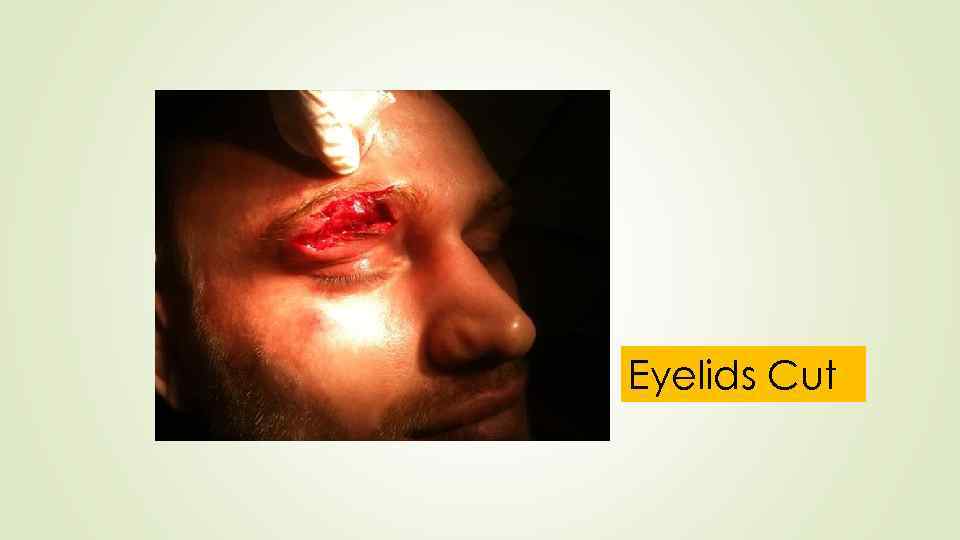 Eyelids Cut 