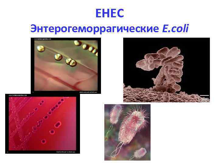 ЕНЕС Энтерогеморрагические E. coli 