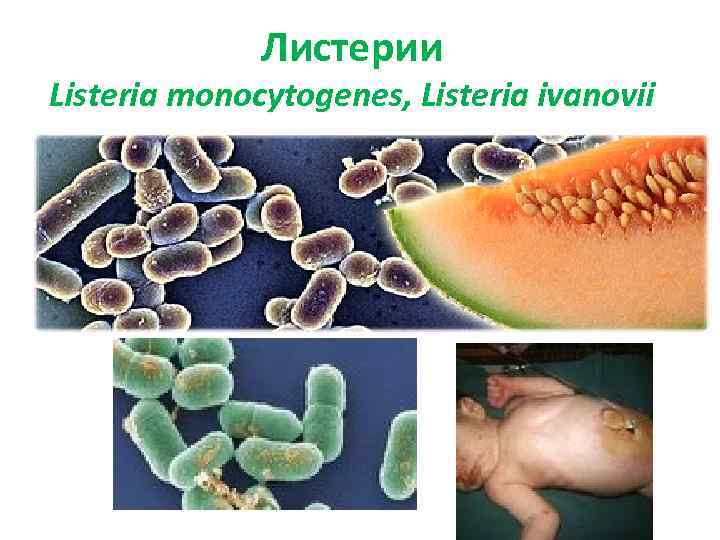 Листерии Listeria monocytogenes, Listeria ivanovii 