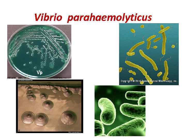 Vibrio parahaemolyticus 