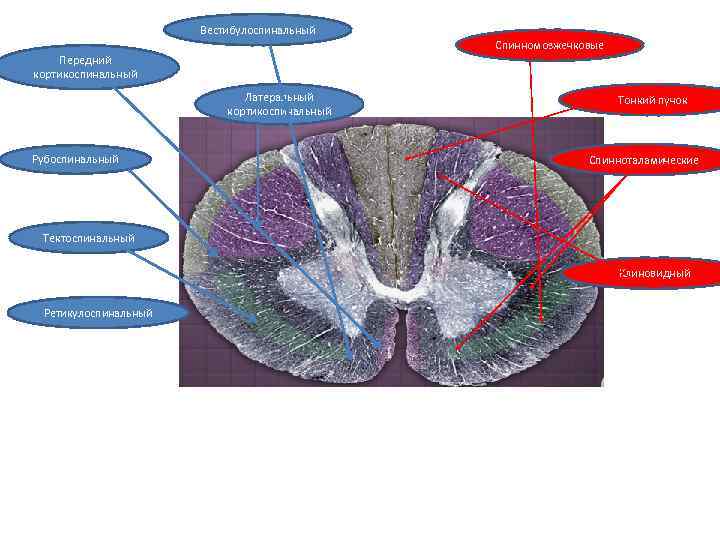 Вестибулоспинальный Спинномозжечковые Передний кортикоспинальный Латеральный кортикоспинальный Рубоспинальный Тонкий пучок Спинноталамические Тектоспинальный Клиновидный Ретикулоспинальный 