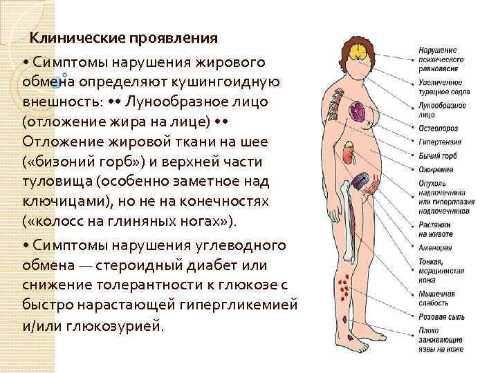  Клинические проявления • Симптомы нарушения жирового обмена определяют кушингоидную внешность: • • Лунообразное