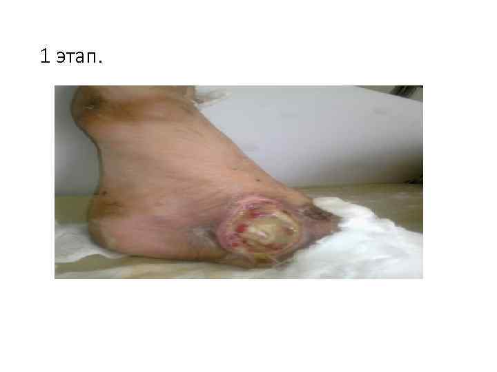 1 этап. 