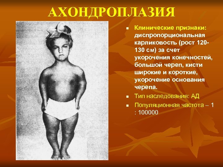 АХОНДРОПЛАЗИЯ n n n Клинические признаки: диспропорциональная карликовость (рост 120130 см) за счет укорочения