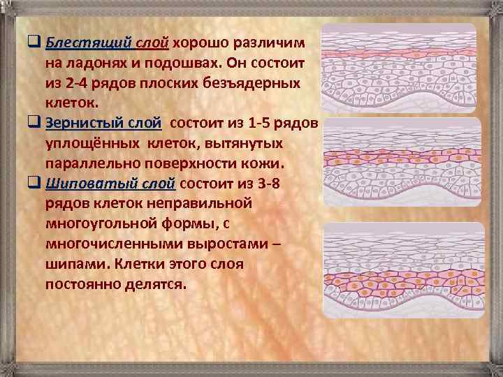 q Блестящий слой хорошо различим на ладонях и подошвах. Он состоит из 2 -4