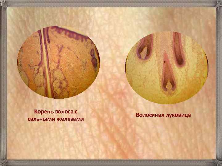 Корень волоса с сальными железами Волосяная луковица 