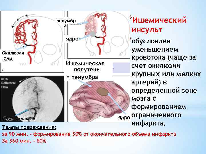 пенумбр а ядро Окклюзия СМА окклюзия Ишемическая полутень = пенумбра *Ишемический инсульт *обусловлен уменьшением