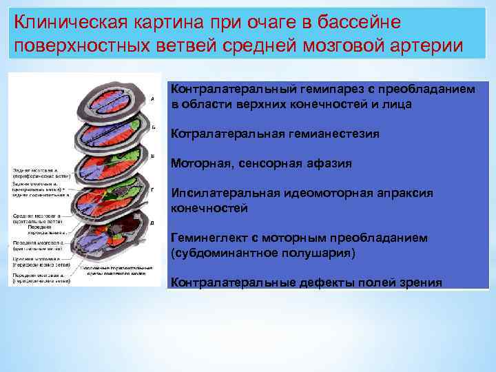 Клиническая картина при очаге в бассейне поверхностных ветвей средней мозговой артерии Контралатеральный гемипарез с