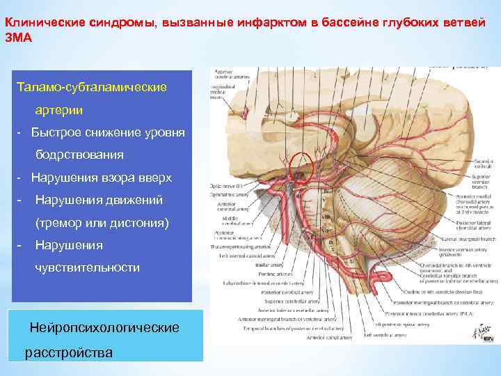 Клинические синдромы, вызванные инфарктом в бассейне глубоких ветвей ЗМА Таламо-субталамические артерии - Быстрое снижение