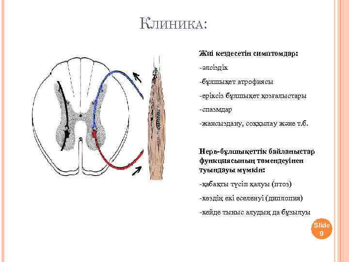 КЛИНИКА: Жиі кездесетін симптомдар: -әлсіздік -бұлшықет атрофиясы -еріксіз бұлшықет қозғалыстары -спазмдар -жансыздану, соққылау және