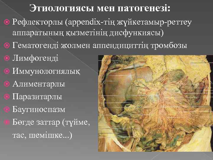 Этиологиясы мен патогенезі: Рефлекторлы (appendix-тің жүйкетамыр-реттеу аппаратының қызметінің дисфункиясы) Гематогенді жолмен аппендициттің тромбозы Лимфогенді
