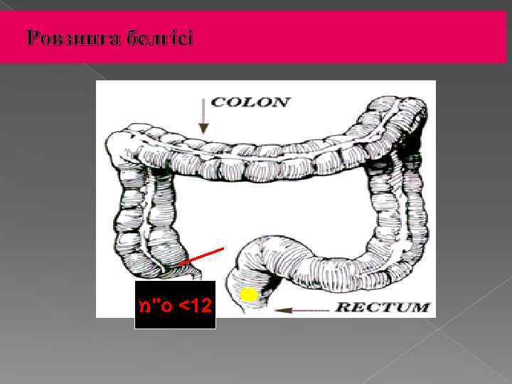 Ровзинга белгісі 21< ס"מ 