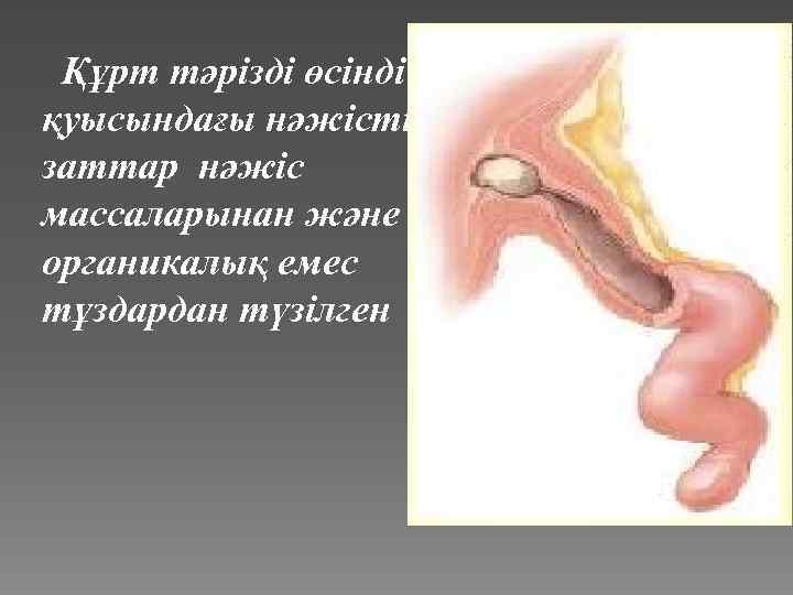 Құрт тәрізді өсінді қуысындағы нәжістік заттар нәжіс массаларынан және органикалық емес тұздардан түзілген 