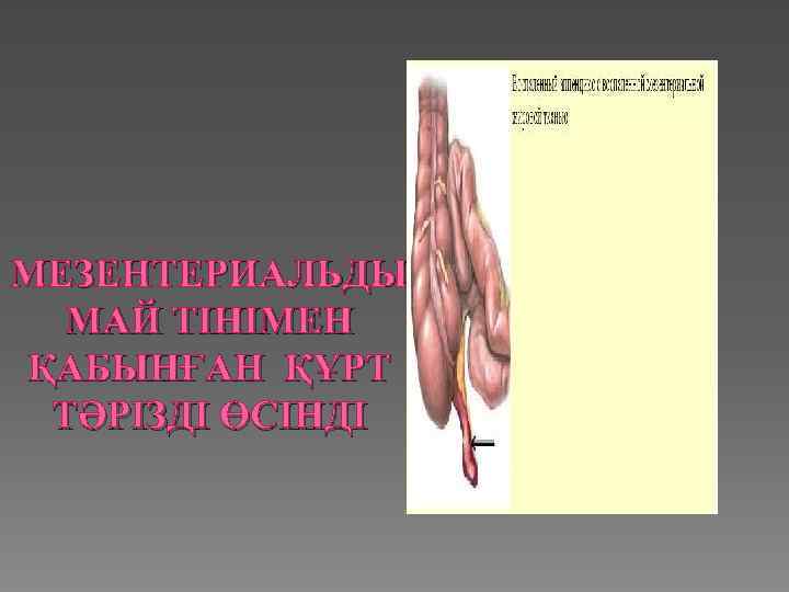 МЕЗЕНТЕРИАЛЬДЫ МАЙ ТІНІМЕН ҚАБЫНҒАН ҚҰРТ ТӘРІЗДІ ӨСІНДІ 