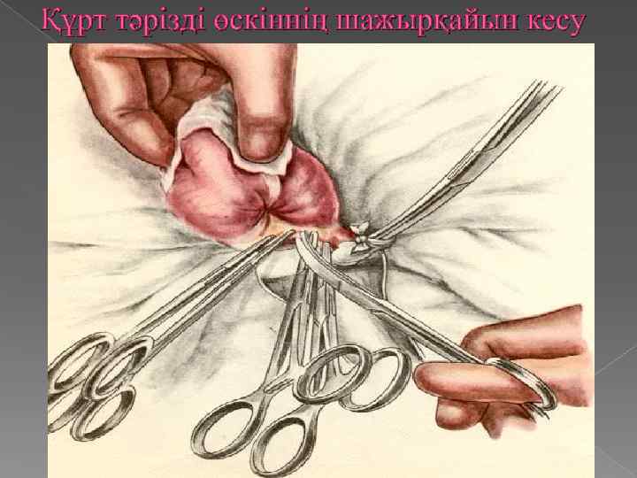 Құрт тәрізді өскіннің шажырқайын кесу 