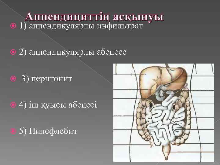 Аппендициттің асқынуы 1) аппендикулярлы инфильтрат 2) аппендикулярлы абсцесс 3) перитонит 4) іш қуысы абсцесі