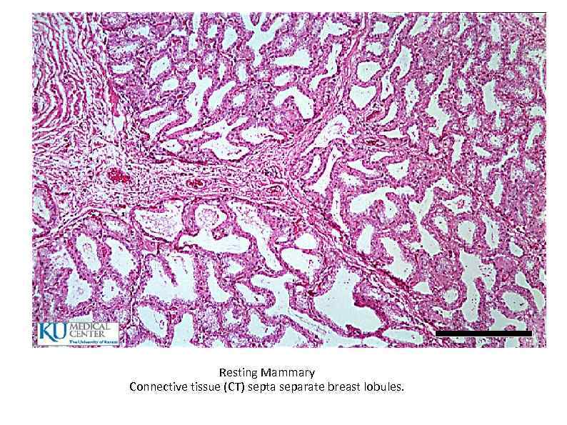 Resting Mammary Connective tissue (CT) septa separate breast lobules. 