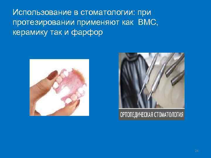 Использование в стоматологии: при протезировании применяют как ВМС, керамику так и фарфор 24 