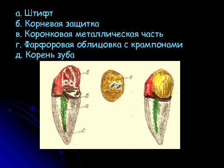 Штифтовые конструкции