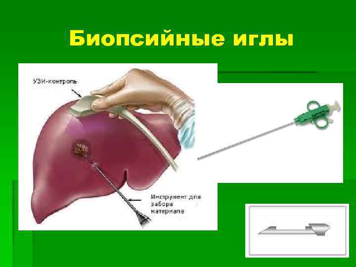 Биопсийные иглы 