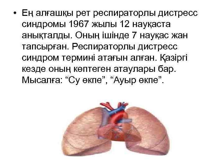 • Ең алғашқы рет респираторлы дистресс синдромы 1967 жылы 12 науқаста анықталды. Оның