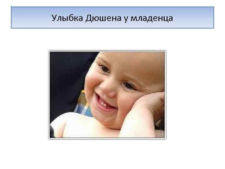 Улыбка Дюшена у младенца 