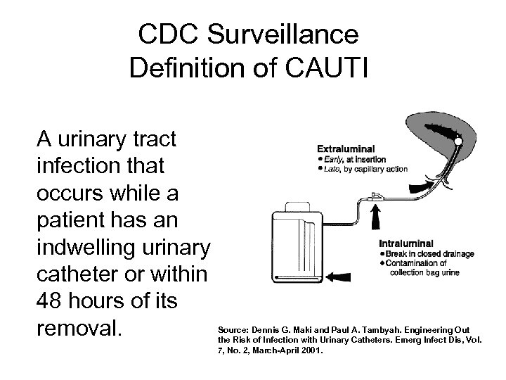 CDC Surveillance Definition of CAUTI A urinary tract infection that occurs while a patient
