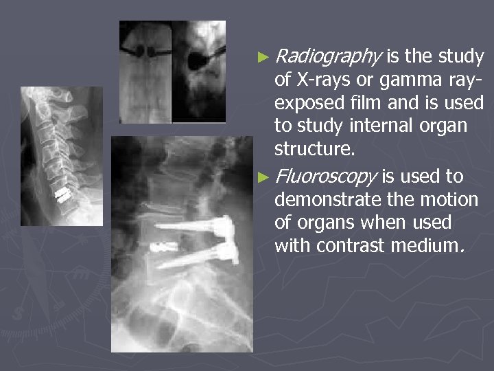 ► Radiography is the study of X-rays or gamma rayexposed film and is used