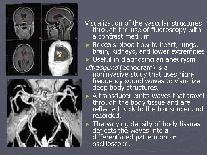 Visualization of the vascular structures through the use of fluoroscopy with a contrast medium