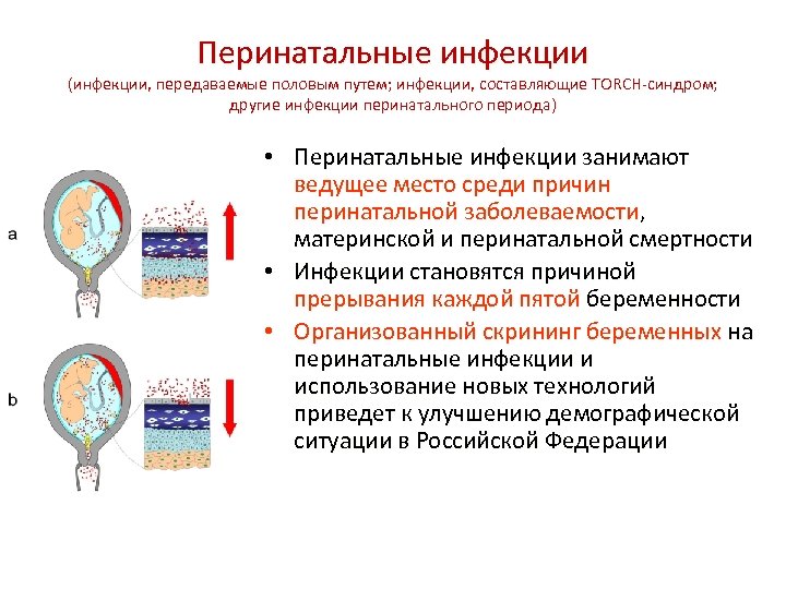 Перинатальные инфекции (инфекции, передаваемые половым путем; инфекции, составляющие TORCH-синдром; другие инфекции перинатального периода) •