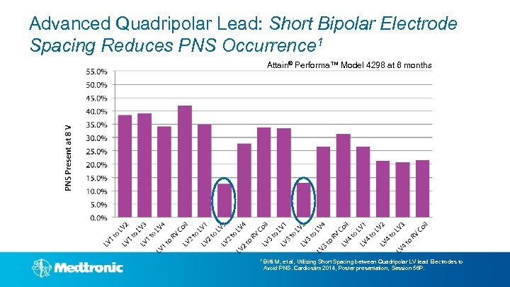 Advanced Quadripolar Lead: Short Bipolar Electrode Spacing Reduces PNS Occurrence 1 Attain® Performa™ Model