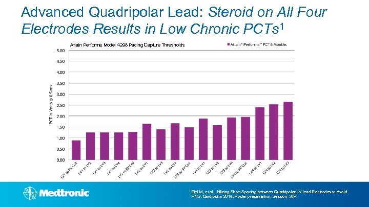 Advanced Quadripolar Lead: Steroid on All Four Electrodes Results in Low Chronic PCTs 1