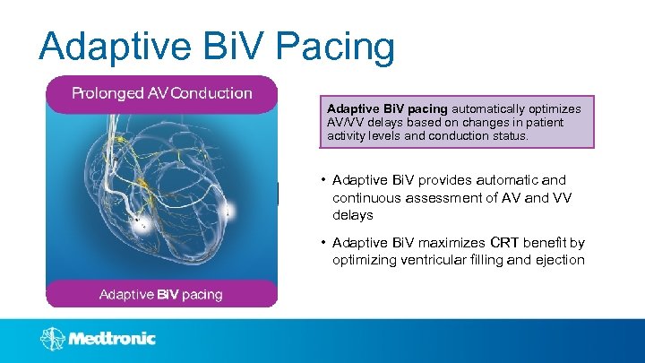 Adaptive Bi. V Pacing Adaptive Bi. V pacing automatically optimizes AV/VV delays based on