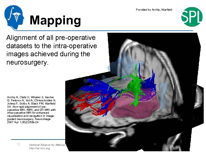 Provided by Archip, Warfield Mapping Alignment of all pre-operative datasets to the intra-operative images