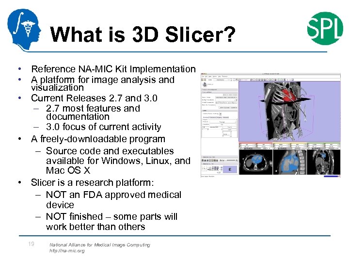 What is 3 D Slicer? • Reference NA-MIC Kit Implementation • A platform for